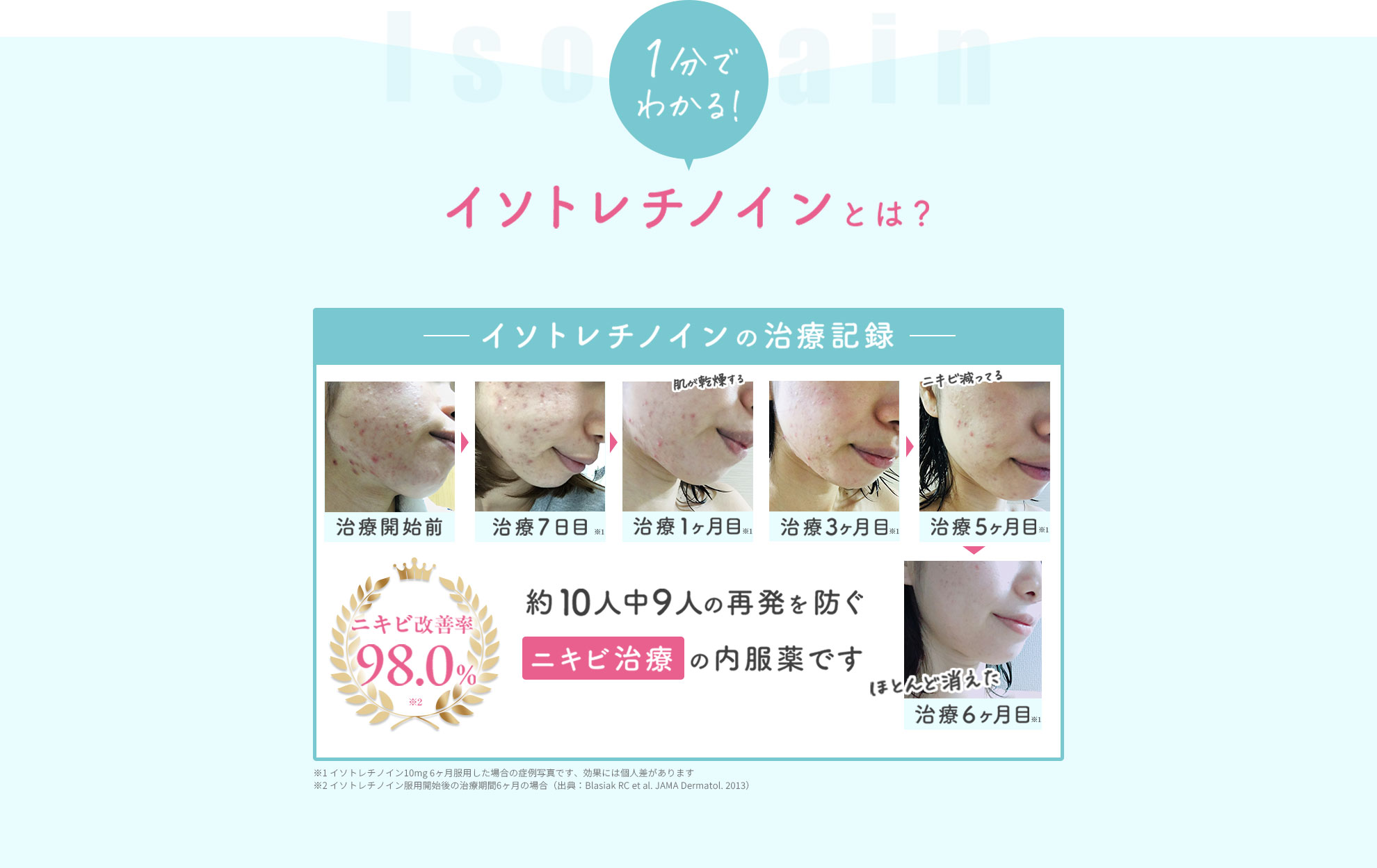 1分でわかる！6ヶ月間のニキビ改善の記録